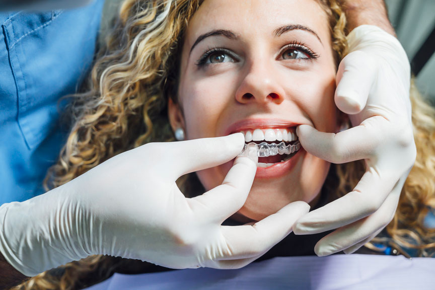 A Dentist Gently Inserts a Clear Aligner Onto a Patient's Teeth