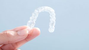 What to Know About Invisalign