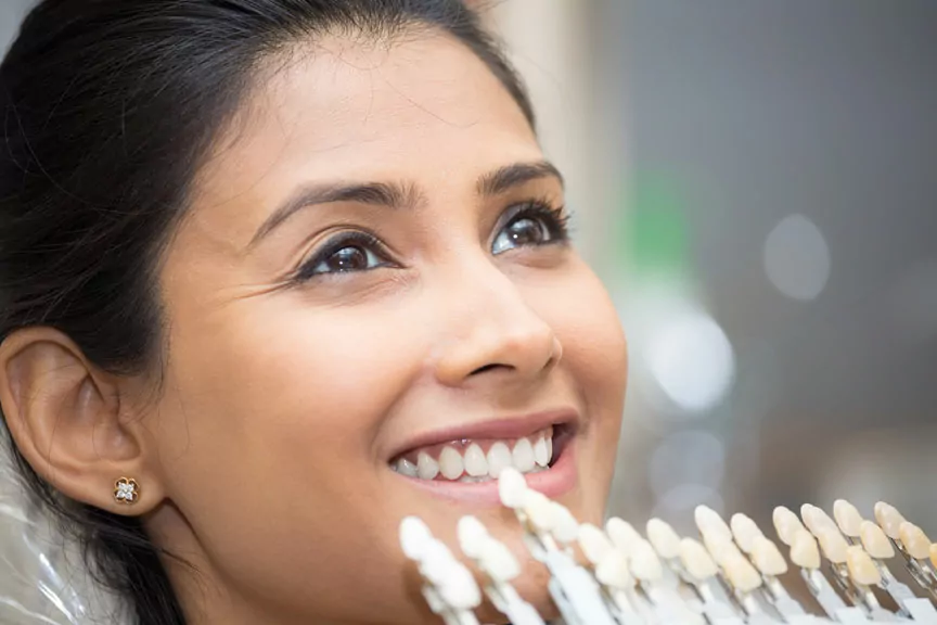 Shade Guide At Woman's Mouth To Check Shade Of Teeth