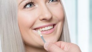 Dental Veneers 101: Choosing the Right Veneer Teeth in Houston